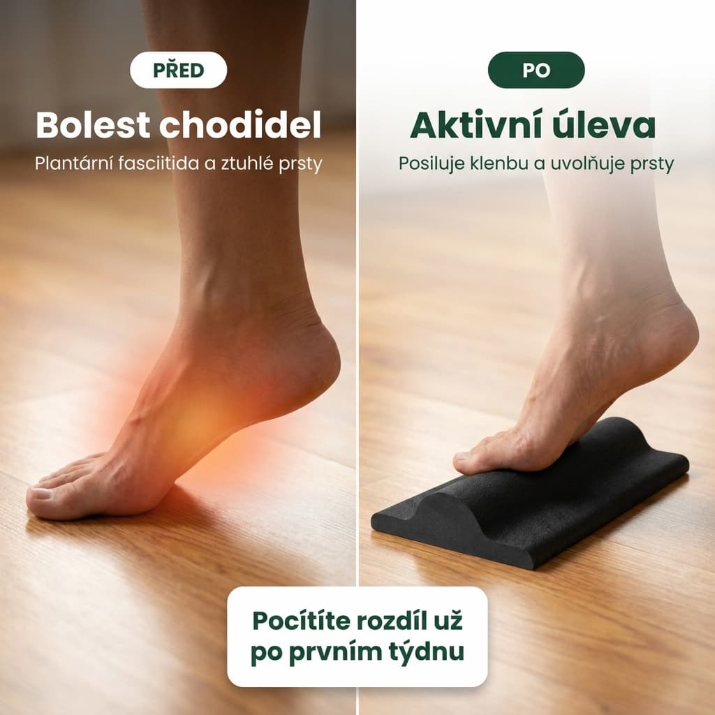 Protahovač chodidla před a po – úleva od bolesti chodidel
